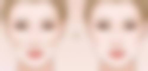 四、不按要求穿塑身衣的后果