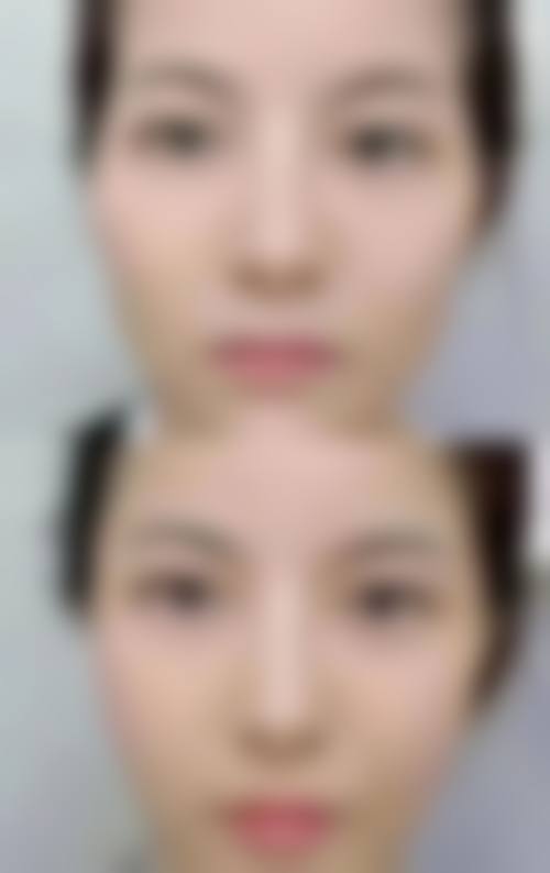 五、东莞市厚街医院皮肤美容科价格表