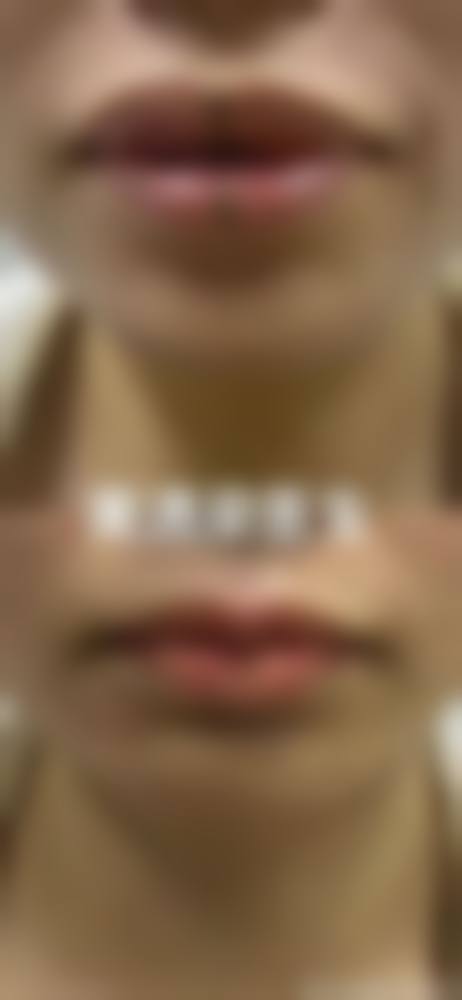 五、阜阳皮肤病医院医疗美容科价格表