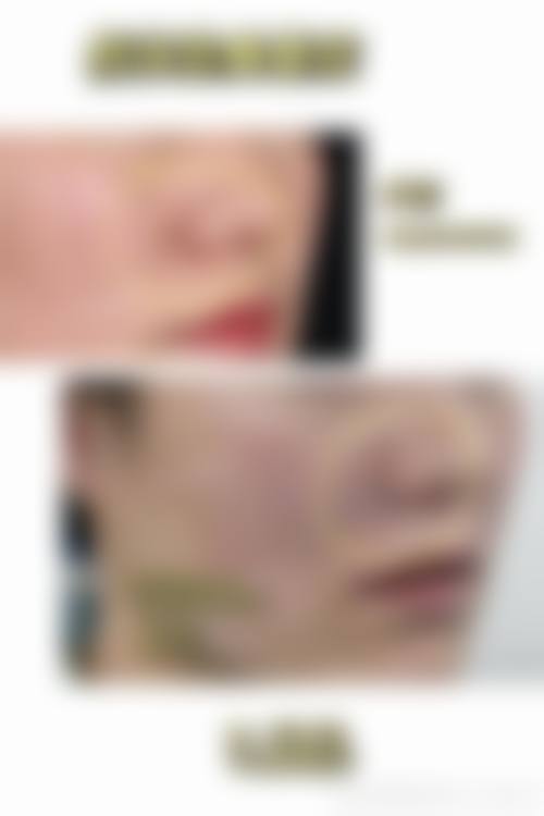 八、阜阳皮肤病医院医疗美容科真实的患者评价