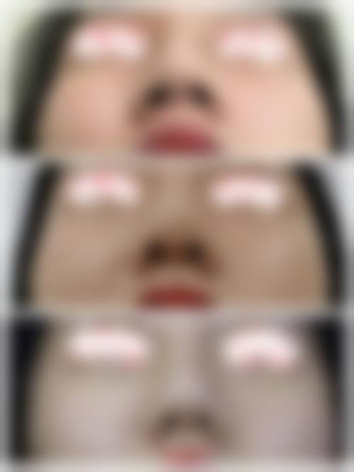 七、阜阳皮肤病医院医疗美容科预约方式