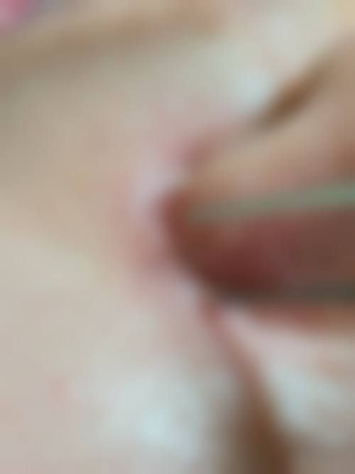 八、余茜医院真实的患者评价