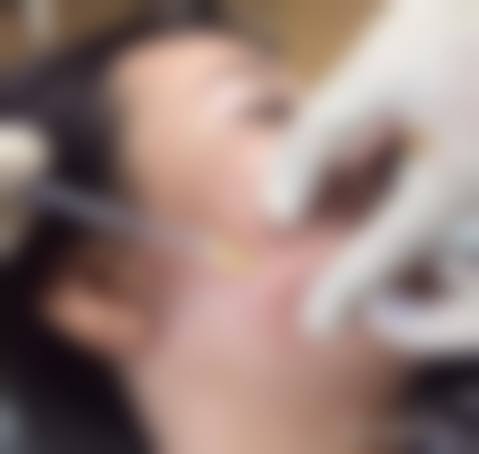 二、余茜医院怎么样？