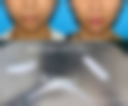 二、阜阳皮肤病医院医疗美容科怎么样？