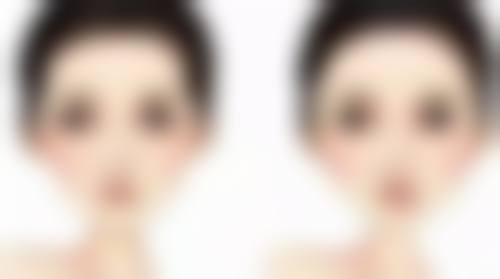 六、全切双眼皮宽修复窄的术后护理要点