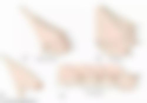 四、治疗后的注意事项与日常护理