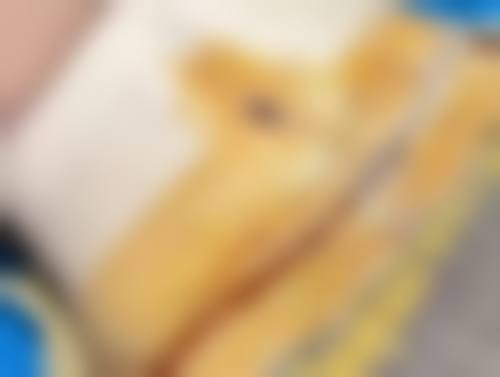 单眼皮小眼睛割双眼皮眼睛会变大吗？真实案例图片为你揭晓答案！ 