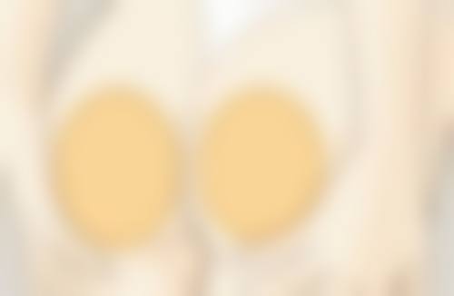 五、全切双眼皮宽修复窄的具体方法