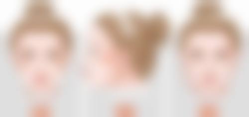 一、单眼皮小眼睛割双眼皮的原理及常见方法