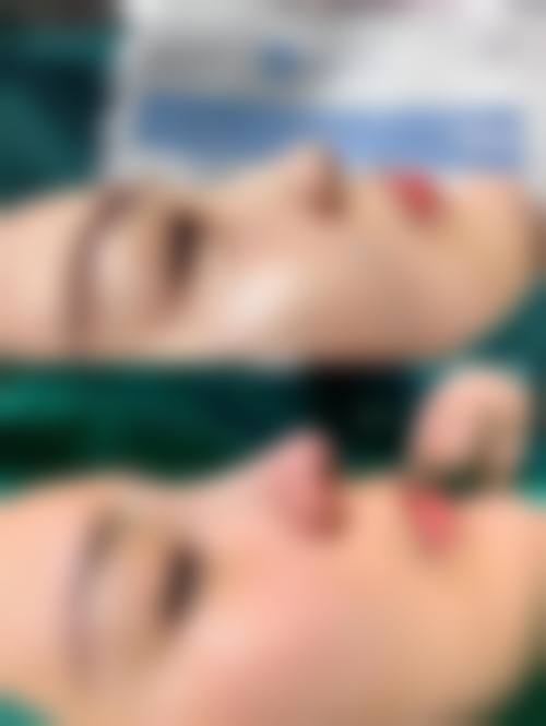 四、成都锦一医院医疗美容整形科特色项目