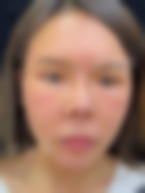 五、成都锦一医院医疗美容整形科价格表