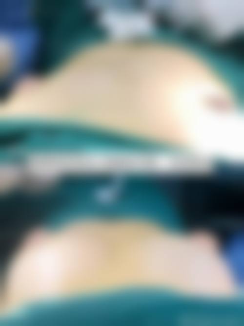 八、成都锦一医院医疗美容整形科真实的患者评价