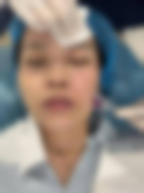 八、成都芊蜜轻颜整形医院真实的患者评价