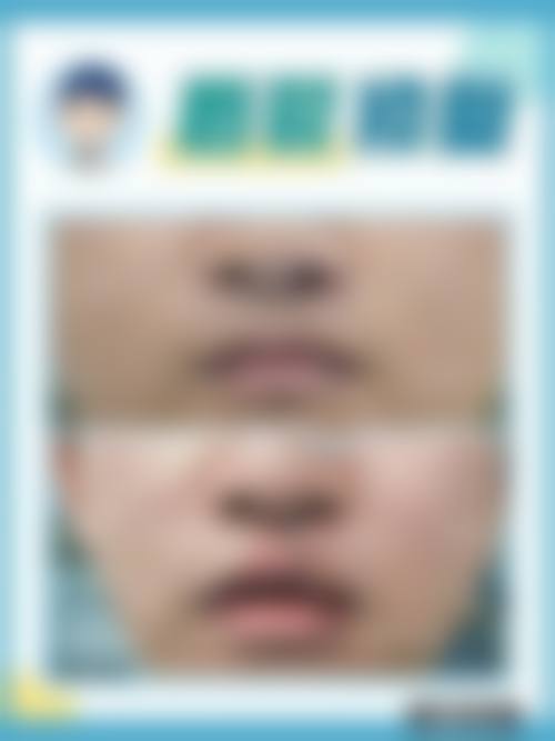 二、成都芊蜜轻颜整形医院怎么样？