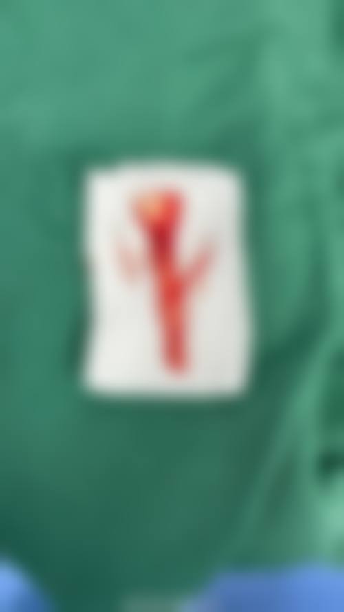 三、刘晓燕技术优势