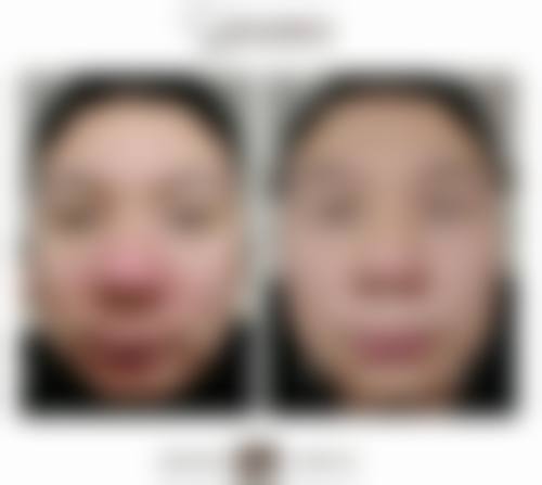 八、昆明善婷医疗美美容诊所真实的患者评价