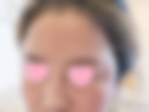 五、成都芊蜜轻颜整形医院价格表