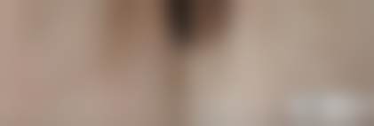 四、韩国WOOA整形外科医院特色项目