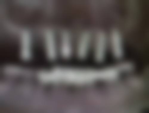 三、埋线双眼皮一个宽一个窄什么情况需要修复？