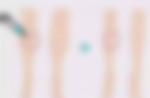 怎样去除脸上的摔伤疤痕？掌握这些小妙招如按摩姜片、用凝胶等淡化效果超棒