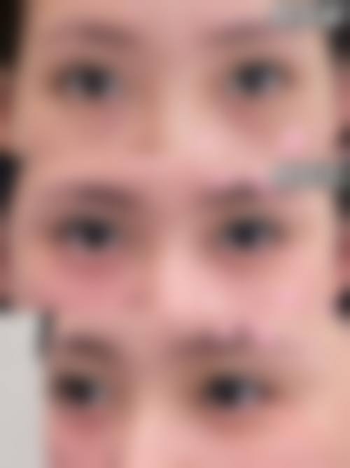 四、深圳源美整形医疗美容医院特色项目