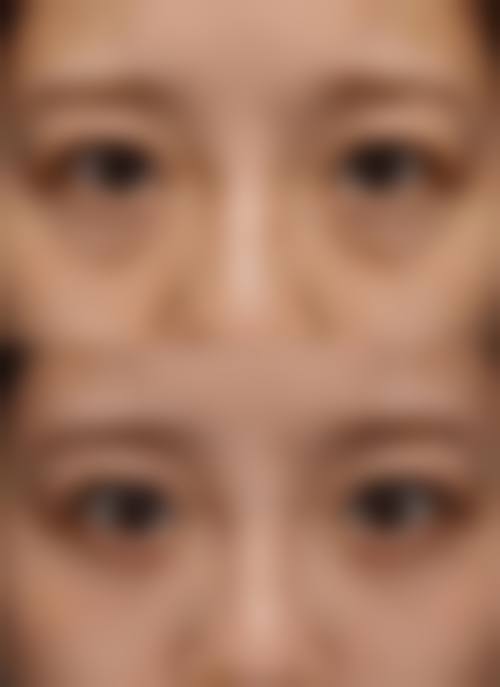 二、浙江绍兴上虞人民医院整形科怎么样？