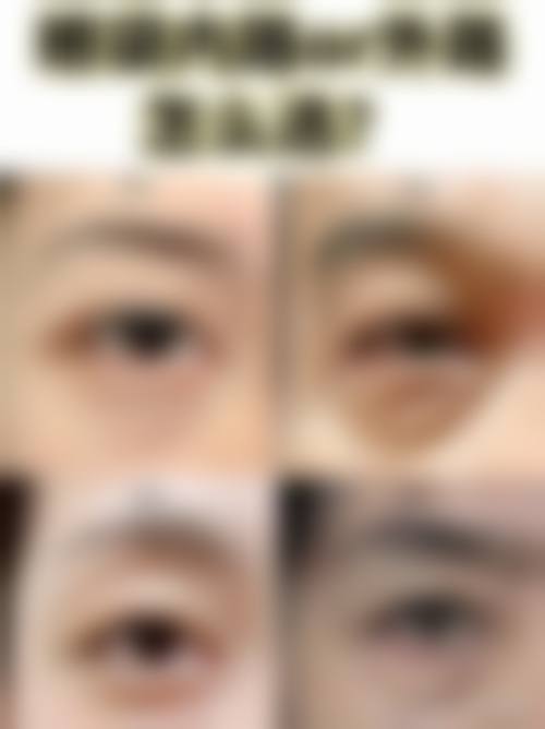 三、浙江绍兴上虞人民医院整形科诊疗项目有哪些？