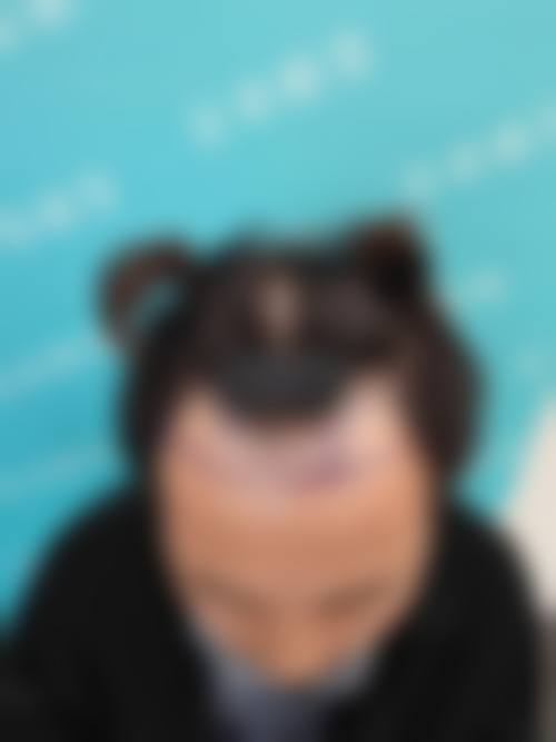 七、沈阳毛发移植及再生研究中 心地址及交通