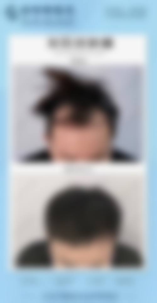 八、沈阳毛发移植及再生研究中 心预约方式