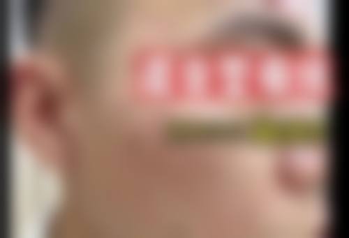 八、安源星悦医疗美容诊所真实的患者评价