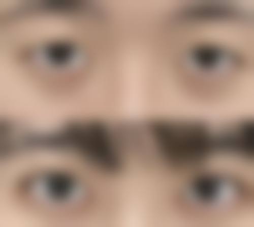 七、深圳源美整形医疗美容医院预约方式