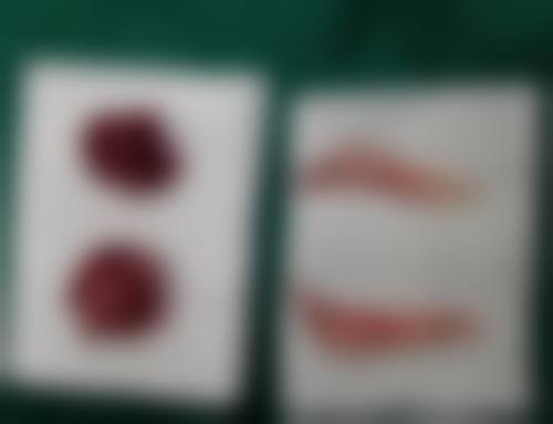 三、深圳源美整形医疗美容医院诊疗项目有哪些?