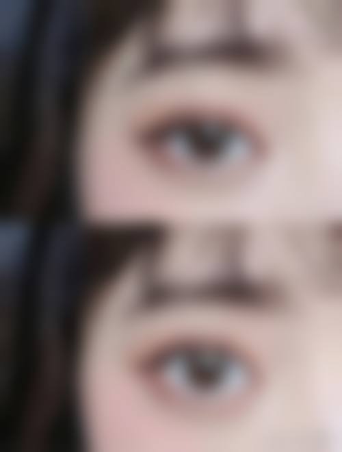 九、浙江绍兴上虞人民医院整形科真实的患者评价