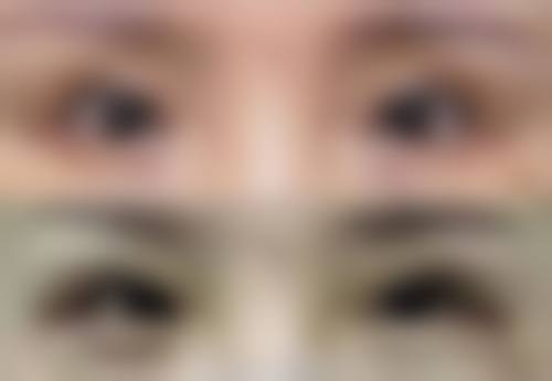 八、浙江绍兴上虞人民医院整形科预约方式