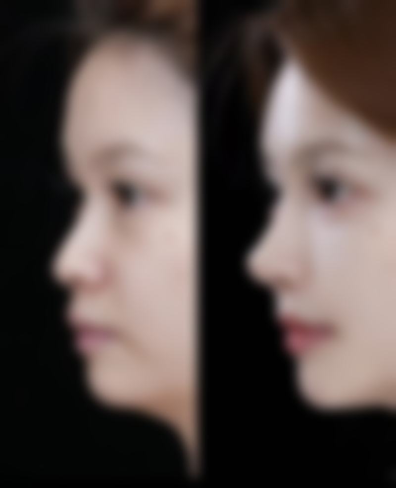 六、眼霜真的能去眼袋和黑眼圈吗?保持好心态特别重要