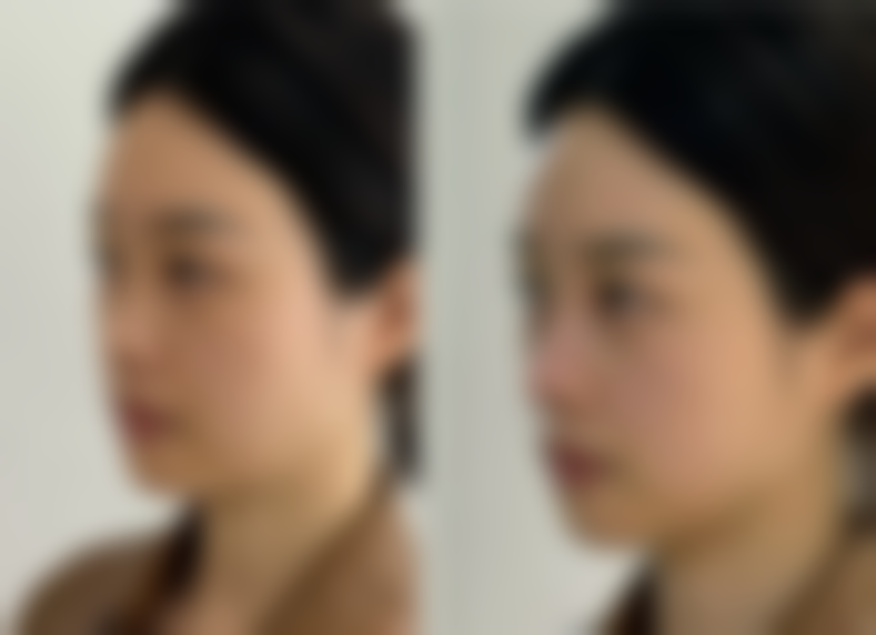 眼霜真的能去眼袋和黑眼圈吗？女生必知的眼霜作用、局限与科学护理建议 