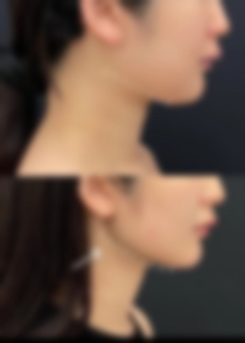 四、轻医美方案