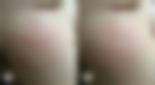 六、患者选择建议