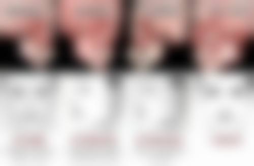 二、切开双眼皮的常见危害和后遗症