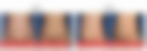 三、专精矫正方法