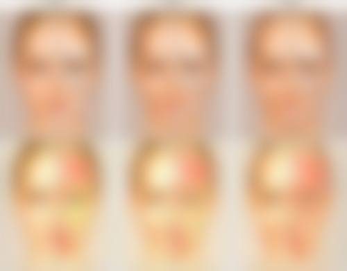 六、卷发棒烫伤后不同类型红色疤痕的医美方案