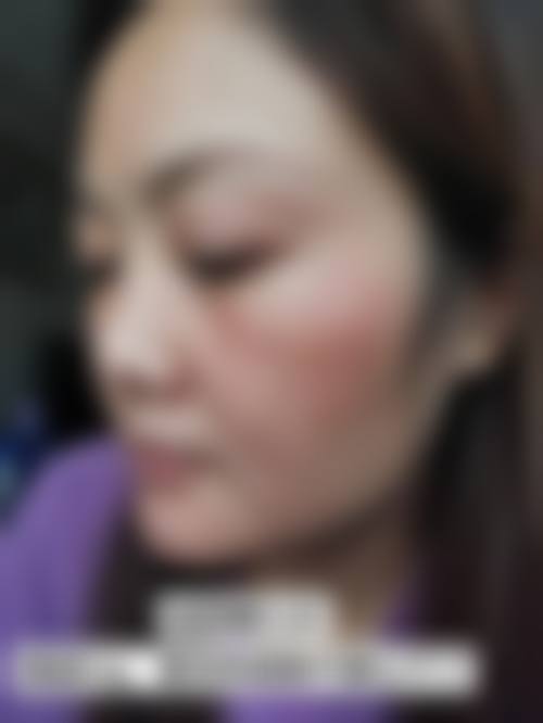 五、绵阳市人民医院烧伤整形科价格表