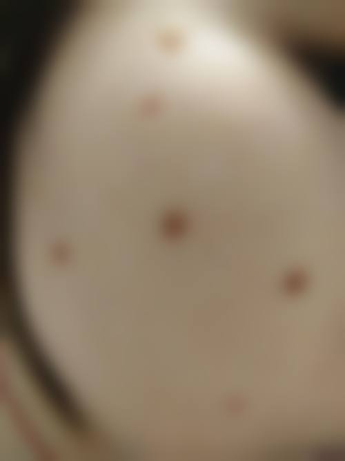 八、绵阳市人民医院烧伤整形科真实的患者评价