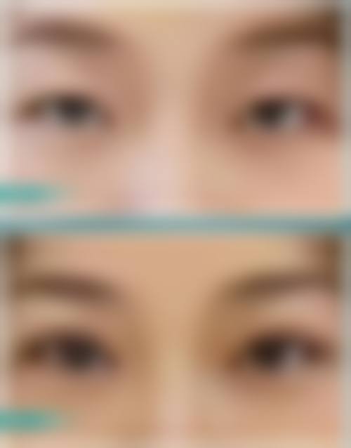 五、杨吉怎么预约?