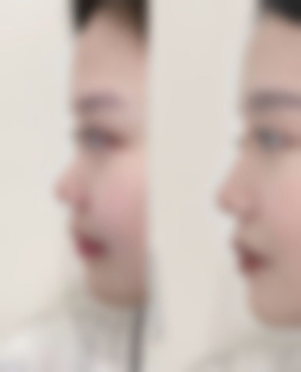 四、若坚持尝试滚针需遵循的原则