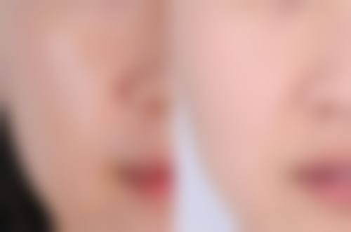 四、南宁美人制造整形美容特色项目