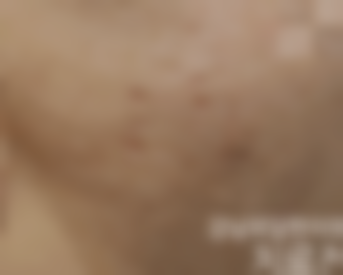 韩国露潭韩医院江南总店