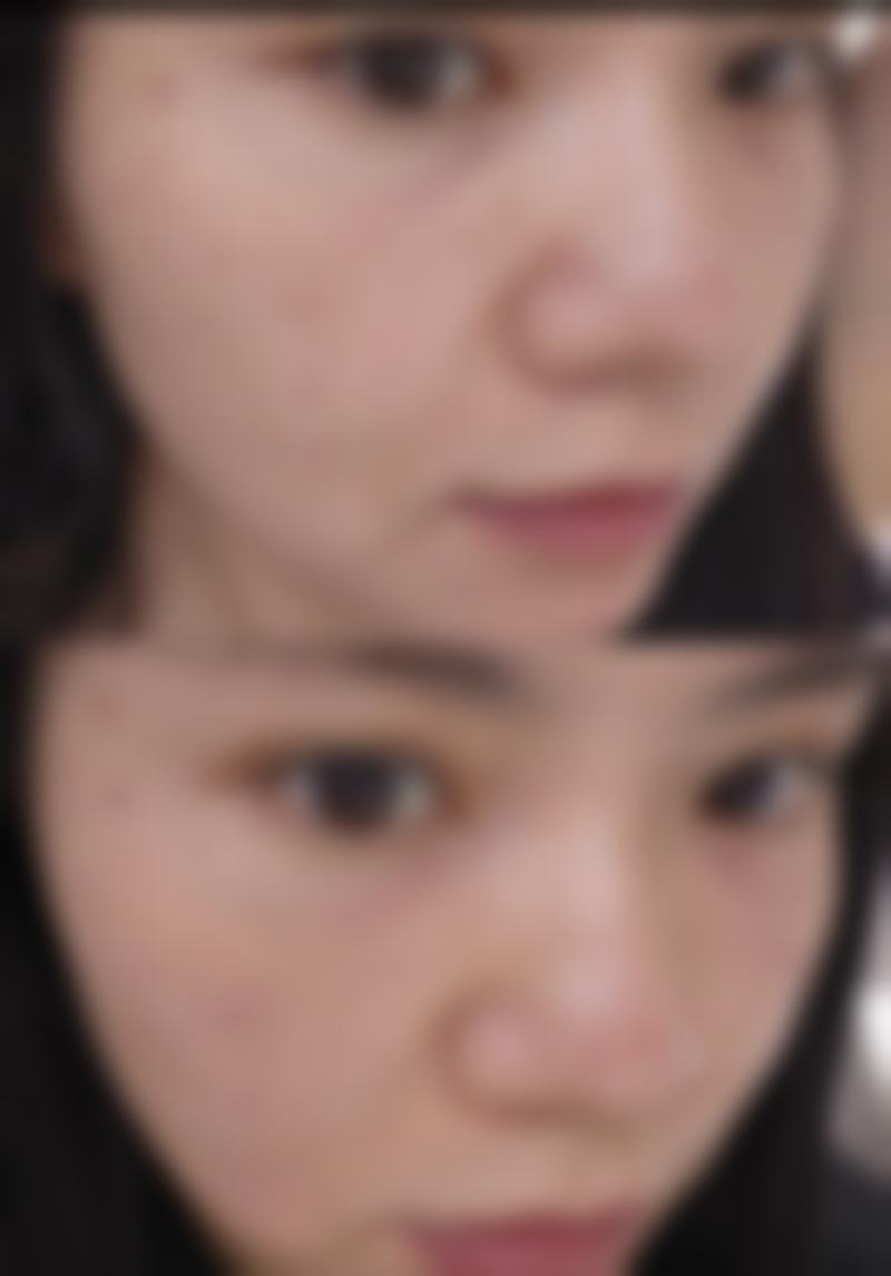 一、眼睛按摩仪对去除眼袋的作用机制