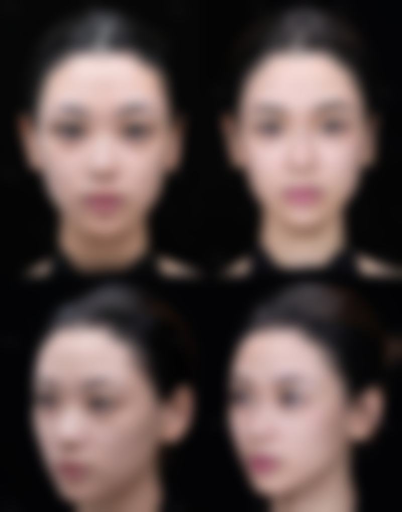 四、促进磕伤的疤痕修复的方法