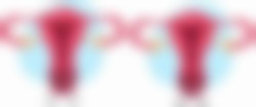 六、选择医生和术后随访